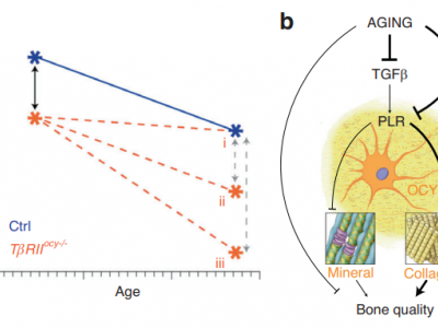 未来骨科 医工融合—文献集萃（四）Bone Research：衰老损害骨细胞对胶原完整性和骨质量的调节
